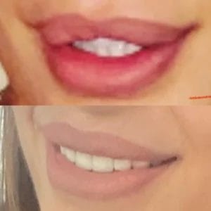 vađenje biopolimera