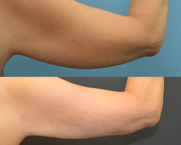 Tiz ustida it uslubidagi fotosurat Tiz ustida it uslubidagi fotosurat