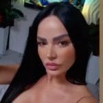 jovana utisci posle operacije